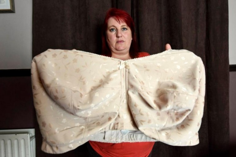 Moje grudi su me umalo ubile: Ispovijest Britanke čije poprsje teži 19 kilograma