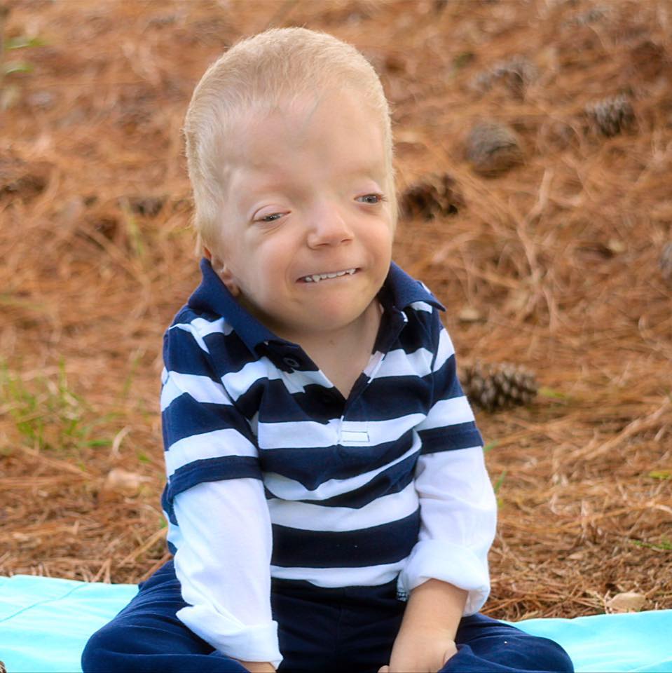 Dječak od 6 godina boluje od rijetke bolesti koja je dobila ime po njemu nakon što je preživio 36 operacija