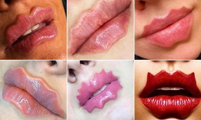 Vražje usne – novi su trend u svijetu ljepote i estetske hirurgije
